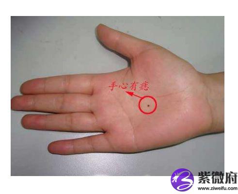 什么是旺财痣一般长在哪里